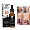 toenail fungus treatment